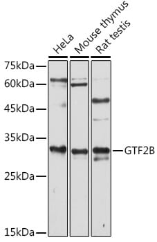 Western blot analysis of extracts of various cell lines, using Anti-GTF2B Antibody (A1708) at 1:1,000 dilution.
Secondary antibody: Goat Anti-Rabbit IgG (H+L) (HRP) (AS014) at 1:10,000 dilution.
Lysates / proteins: 25µg per lane.
Blocking buffer: 3% non-fat dry milk in TBST.
Detection: ECL Basic Kit (RM00020).
Exposure time: 30s.