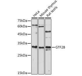 Western Blot - Anti-TFIIB Antibody (A89343) - Antibodies.com
