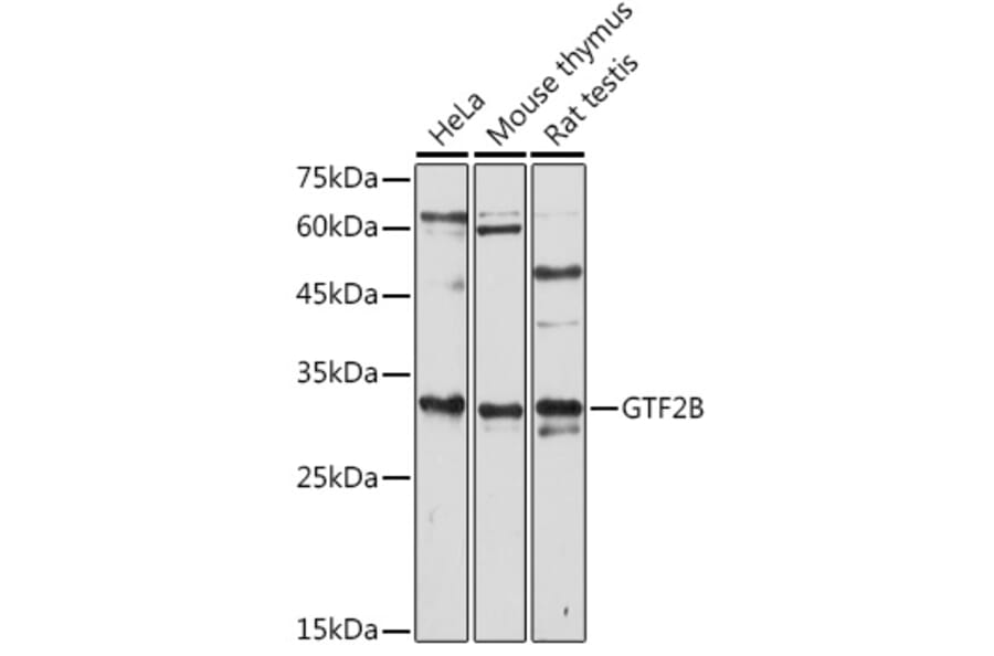 Western Blot - Anti-TFIIB Antibody (A89343) - Antibodies.com