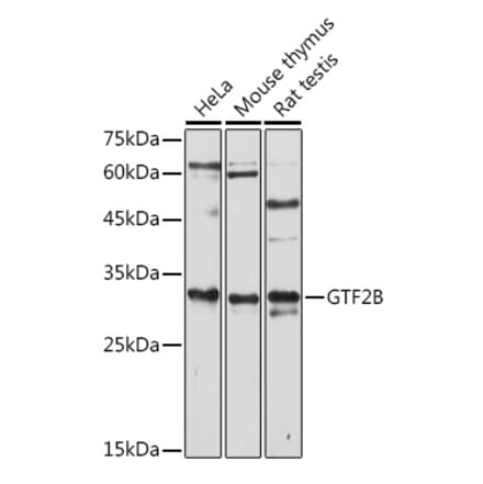 Western Blot - Anti-TFIIB Antibody (A89343) - Antibodies.com