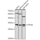 Western Blot - Anti-TFIIB Antibody (A89343) - Antibodies.com