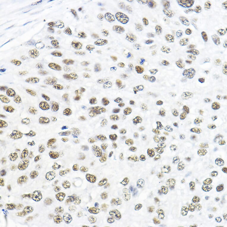 Immunohistochemistry - Anti-TFIIB Antibody (A89343) - Antibodies.com