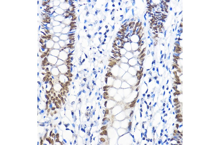 Immunohistochemistry - Anti-TFIIB Antibody (A89343) - Antibodies.com