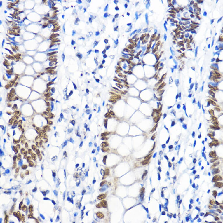 Immunohistochemistry - Anti-TFIIB Antibody (A89343) - Antibodies.com