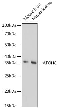 Western blot analysis of extracts of various cell lines, using Anti-ATOH8 Antibody (A17232) at 1:1,000 dilution.
Secondary antibody: Goat Anti-Rabbit IgG (H+L) (HRP) (AS014) at 1:10,000 dilution.
Lysates / proteins: 25µg per lane.
Blocking buffer: 3% non-fat dry milk in TBST.
Detection: ECL Basic Kit (RM00020).
Exposure time: 90s.