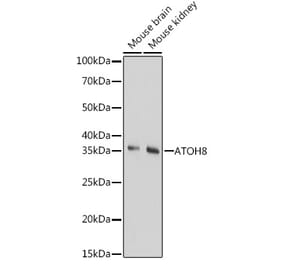 Western Blot - Anti-ATOH8 Antibody (A89344) - Antibodies.com