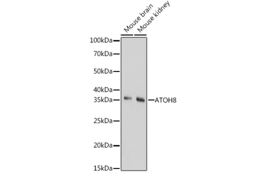 Western Blot - Anti-ATOH8 Antibody (A89344) - Antibodies.com