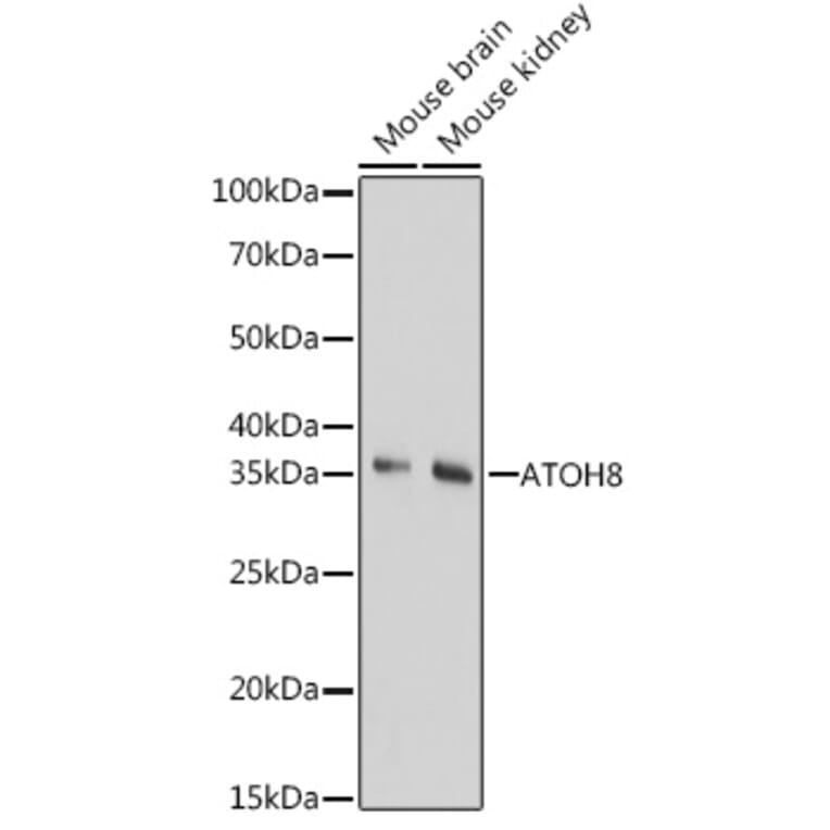 Western Blot - Anti-ATOH8 Antibody (A89344) - Antibodies.com