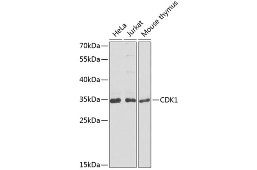 Western Blot - Anti-CDK1 Antibody (A2861) - Antibodies.com