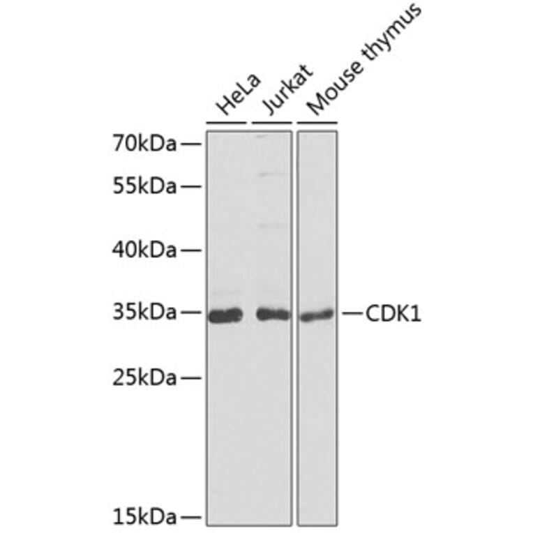 Western Blot - Anti-CDK1 Antibody (A2861) - Antibodies.com