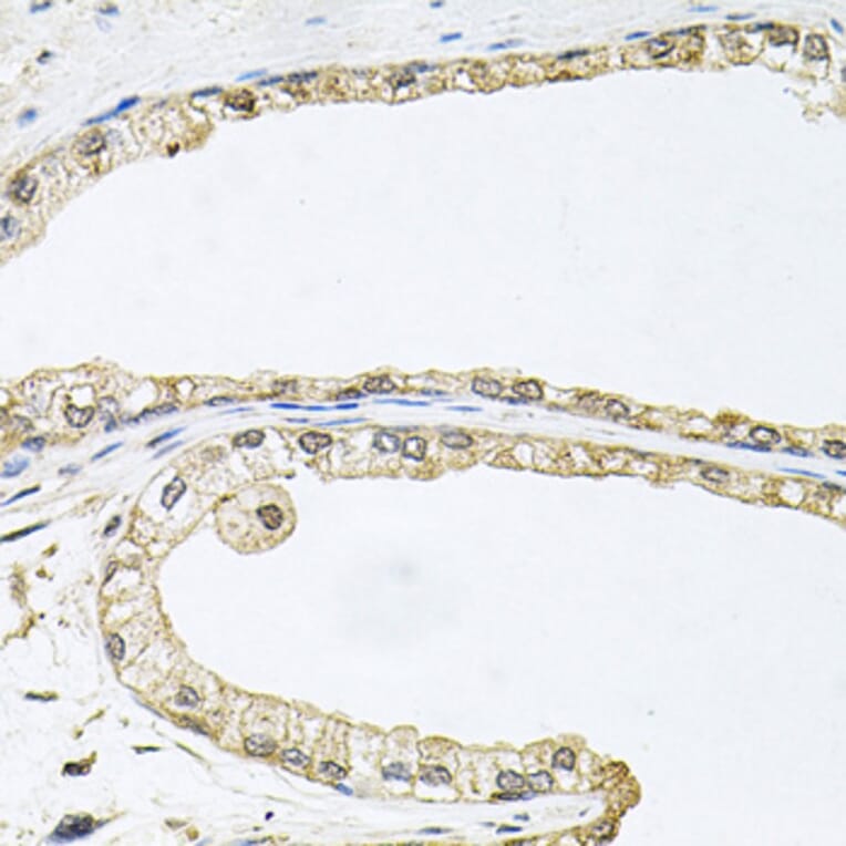Immunohistochemistry - Anti-CDK1 Antibody (A2861) - Antibodies.com