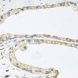 Immunohistochemistry - Anti-CDK1 Antibody (A2861) - Antibodies.com