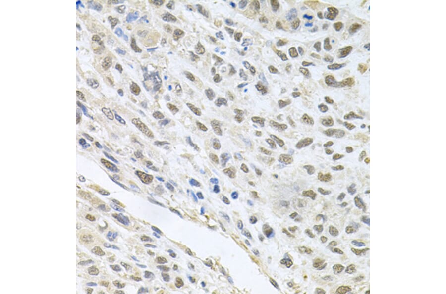 Immunohistochemistry - Anti-CDK1 Antibody (A2861) - Antibodies.com