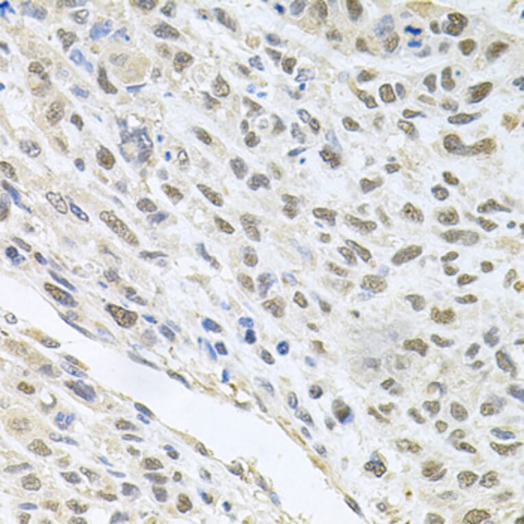 Immunohistochemistry - Anti-CDK1 Antibody (A2861) - Antibodies.com