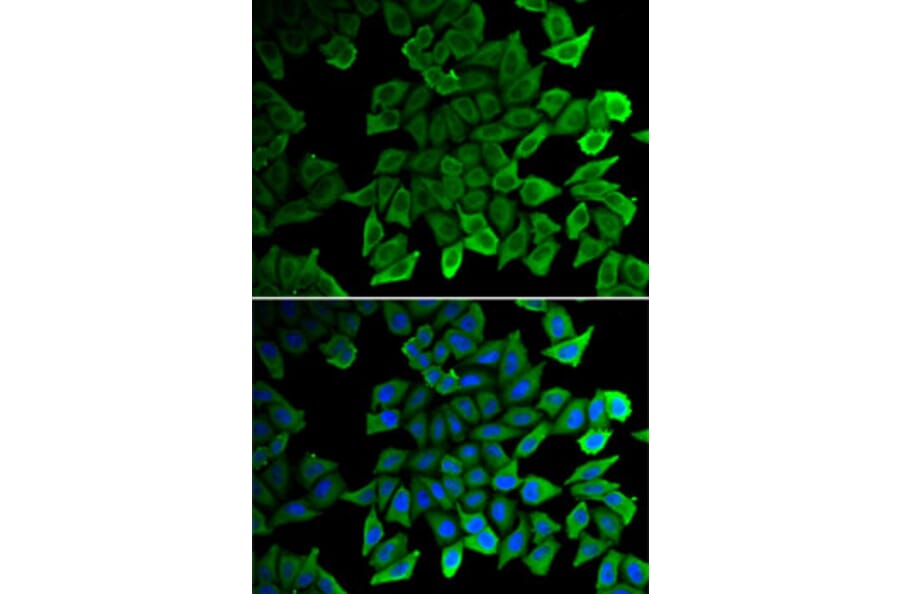 Immunofluorescence - Anti-CDK1 Antibody (A2861) - Antibodies.com