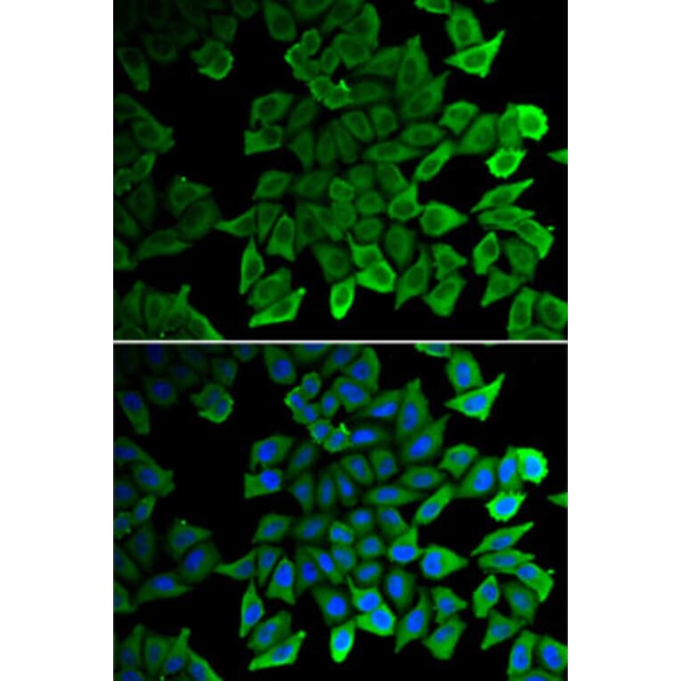 Immunofluorescence - Anti-CDK1 Antibody (A2861) - Antibodies.com