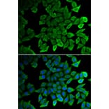 Immunofluorescence - Anti-CDK1 Antibody (A2861) - Antibodies.com