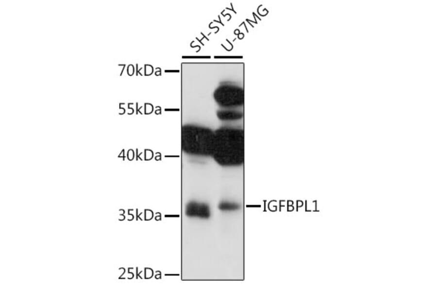Western Blot - Anti-IGFBPL1 Antibody (A89346) - Antibodies.com
