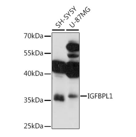 Western Blot - Anti-IGFBPL1 Antibody (A89346) - Antibodies.com