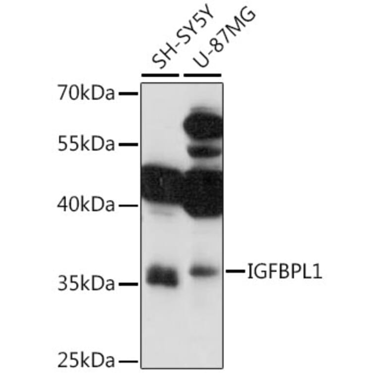 Western Blot - Anti-IGFBPL1 Antibody (A89346) - Antibodies.com