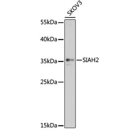 Western Blot - Anti-Siah2 Antibody (A89347) - Antibodies.com