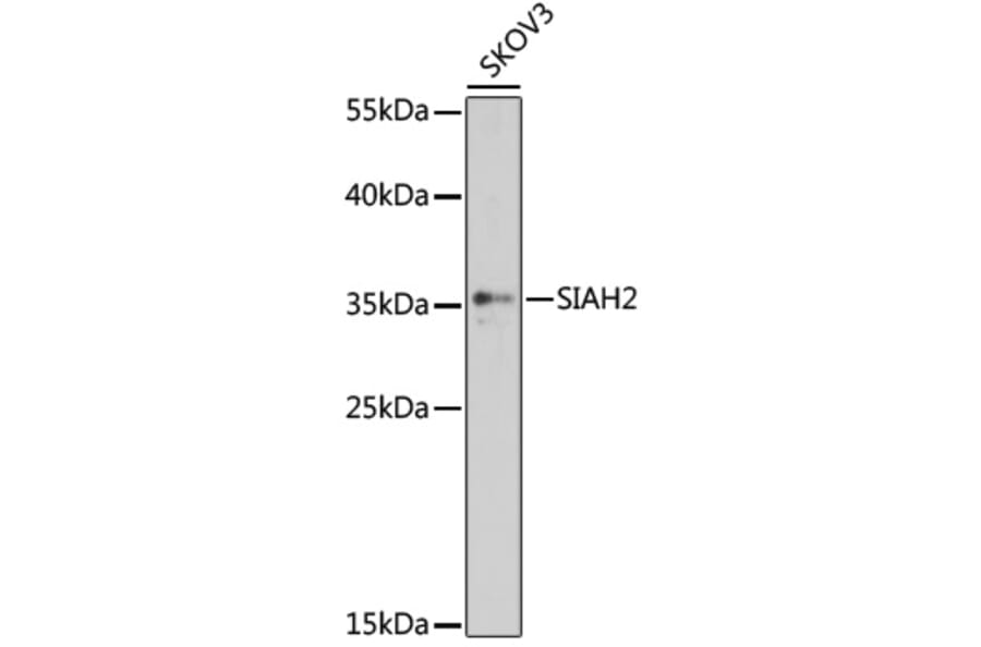 Western Blot - Anti-Siah2 Antibody (A89347) - Antibodies.com
