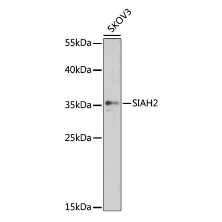 Western Blot - Anti-Siah2 Antibody (A89347) - Antibodies.com