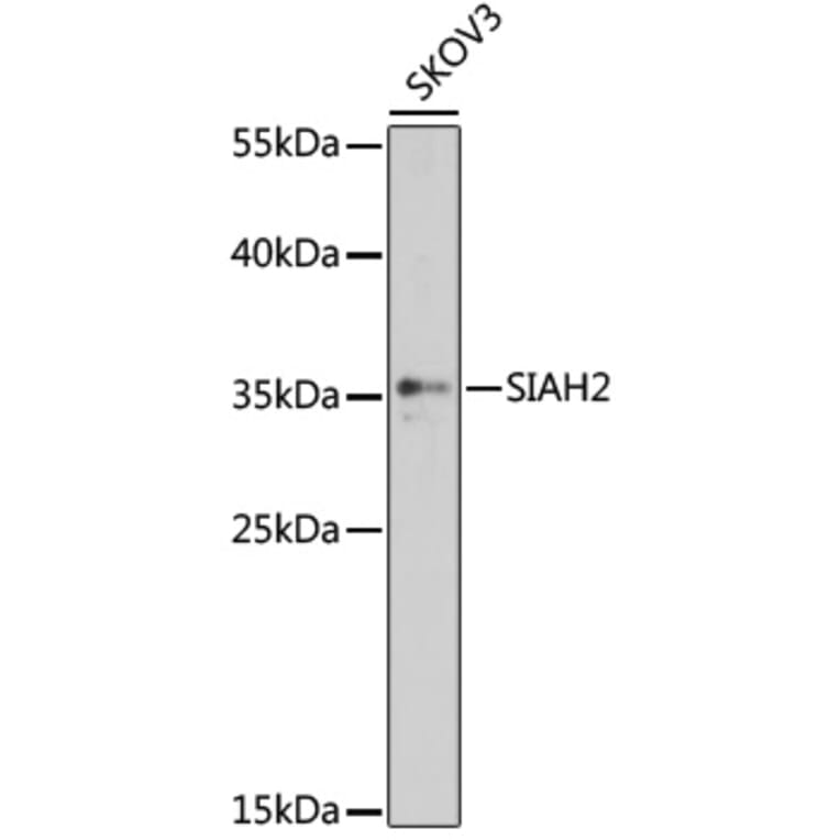 Western Blot - Anti-Siah2 Antibody (A89347) - Antibodies.com