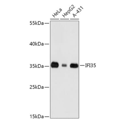 Western Blot - Anti-IFI35 Antibody (A89348) - Antibodies.com