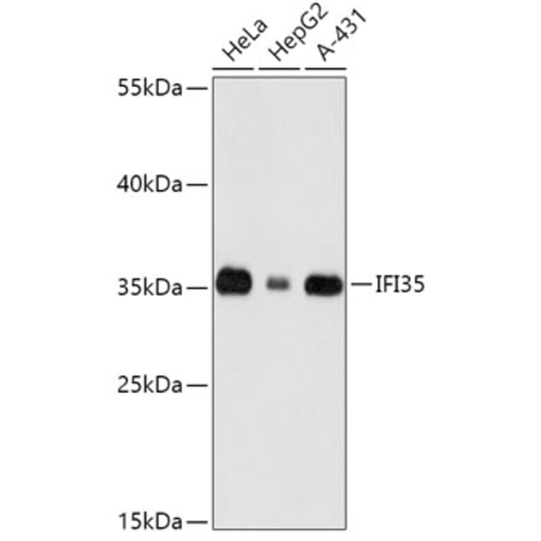 Western Blot - Anti-IFI35 Antibody (A89348) - Antibodies.com