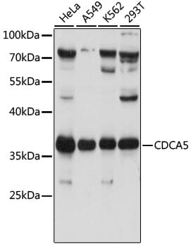 Western blot analysis of extracts of various cell lines, using Anti-CDCA5 Antibody (A16590) at 1:1,000 dilution.
Secondary antibody: Goat Anti-Rabbit IgG (H+L) (HRP) (AS014) at 1:10,000 dilution.
Lysates / proteins: 25µg per lane.
Blocking buffer: 3% non-fat dry milk in TBST.
Detection: ECL Basic Kit (RM00020).
Exposure time: 1s.