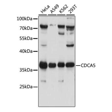 Western Blot - Anti-CDCA5 Antibody (A89350) - Antibodies.com