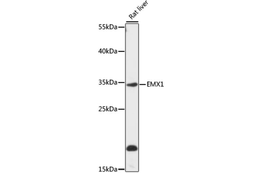 Western Blot - Anti-Emx1 Antibody (A89351) - Antibodies.com