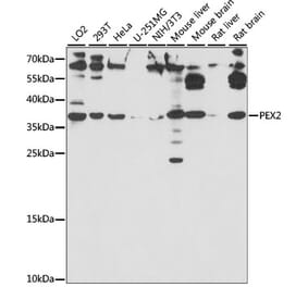 Western Blot - Anti-PAF-1 Antibody (A89353) - Antibodies.com