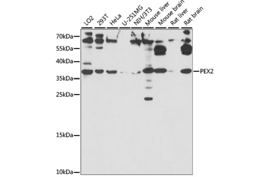 Western Blot - Anti-PAF-1 Antibody (A89353) - Antibodies.com