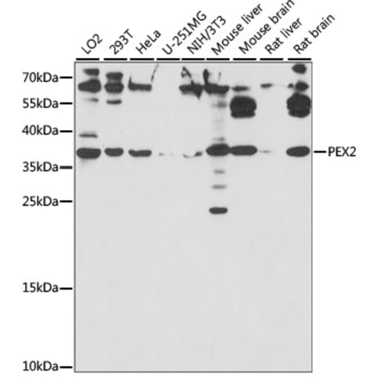 Western Blot - Anti-PAF-1 Antibody (A89353) - Antibodies.com