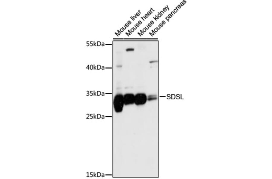 Western Blot - Anti-SDSL Antibody (A89354) - Antibodies.com