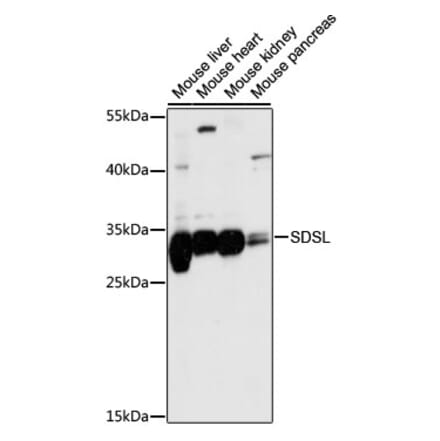 Western Blot - Anti-SDSL Antibody (A89354) - Antibodies.com