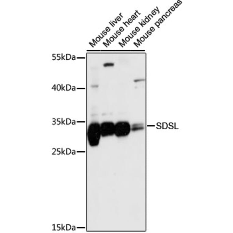 Western Blot - Anti-SDSL Antibody (A89354) - Antibodies.com
