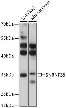 Western blot analysis of extracts of various cell lines, using Anti-SNRNP35 Antibody (A13211) at 1:3000 dilution.
Secondary antibody: Goat Anti-Rabbit IgG (H+L) (HRP) (AS014) at 1:10,000 dilution.
Lysates / proteins: 25µg per lane.
Blocking buffer: 3% non-fat dry milk in TBST.
Detection: ECL Basic Kit (RM00020).
Exposure time: 10s.