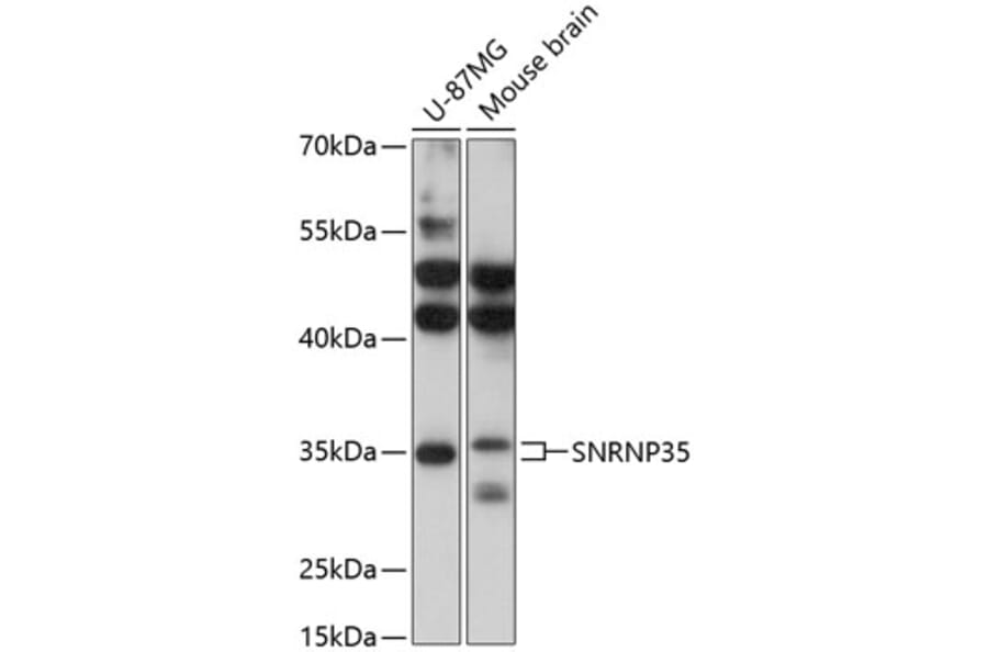 Western Blot - Anti-SNRNP35 Antibody (A89356) - Antibodies.com