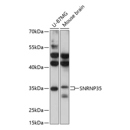 Western Blot - Anti-SNRNP35 Antibody (A89356) - Antibodies.com