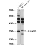 Western Blot - Anti-SNRNP35 Antibody (A89356) - Antibodies.com