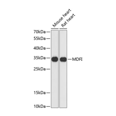 Western Blot - Anti-MDFI Antibody (A89357) - Antibodies.com