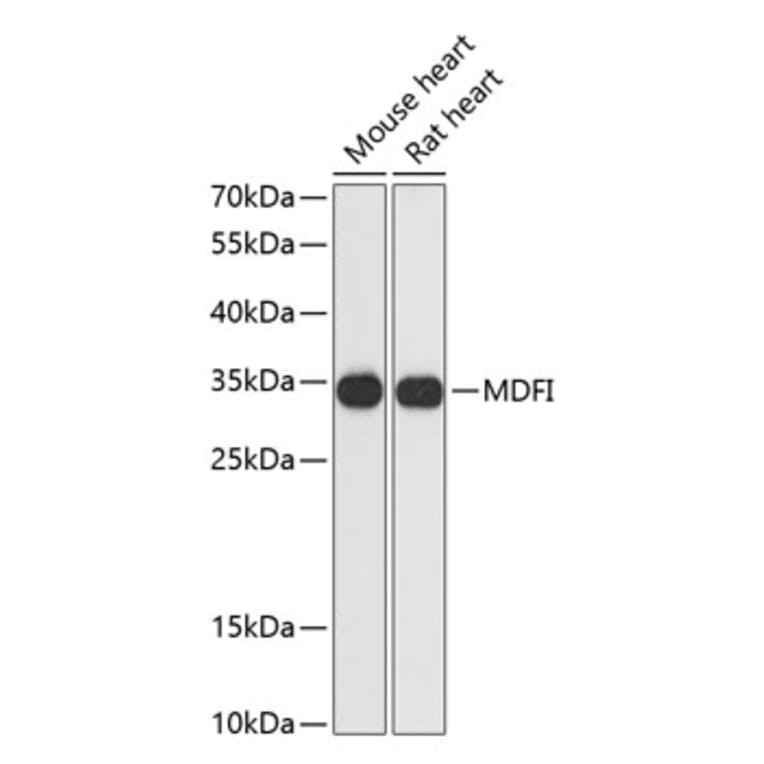 Western Blot - Anti-MDFI Antibody (A89357) - Antibodies.com