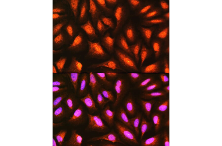Immunofluorescence - Anti-MDFI Antibody (A89357) - Antibodies.com