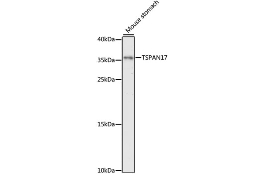 Western Blot - Anti-TSPAN17 Antibody (A89358) - Antibodies.com