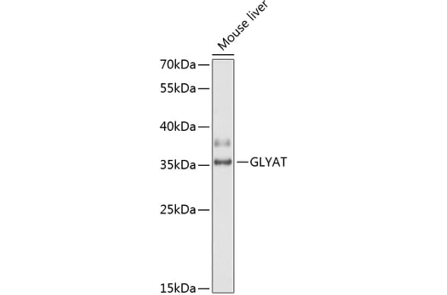 Western Blot - Anti-GLYAT/GAT Antibody (A89359) - Antibodies.com