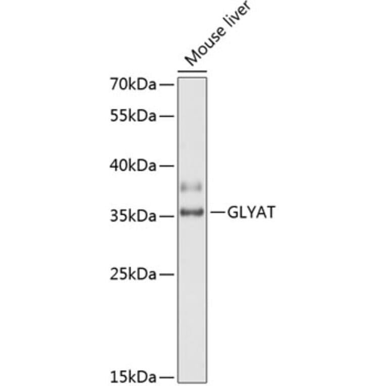 Western Blot - Anti-GLYAT/GAT Antibody (A89359) - Antibodies.com
