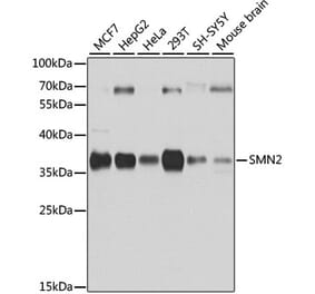 Western Blot - Anti-SMN/Gemin 1 Antibody (A89360) - Antibodies.com